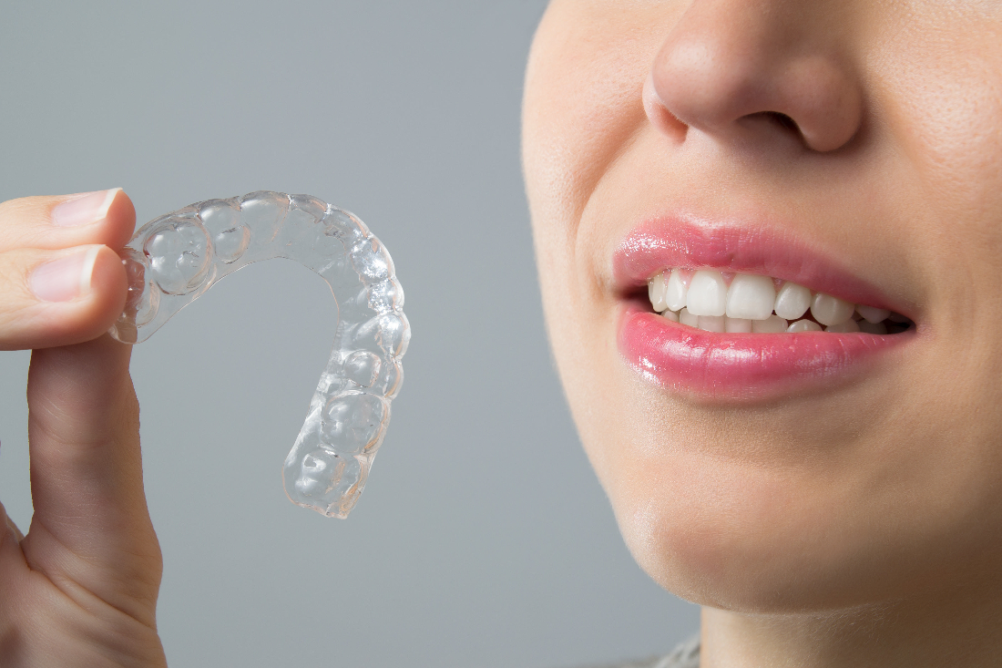 What to Know About Invisible Braces